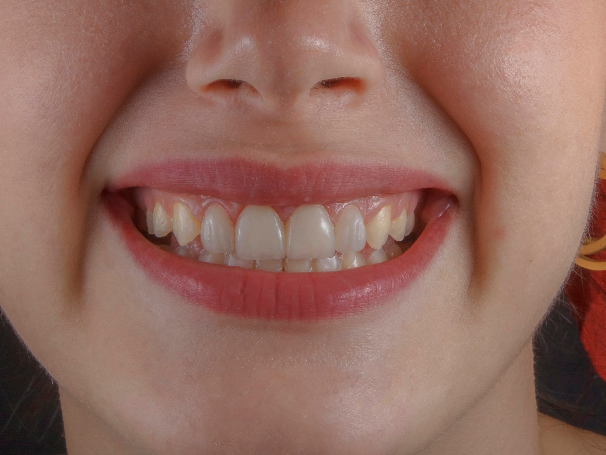 A close study of a smile, lit softly from the front.