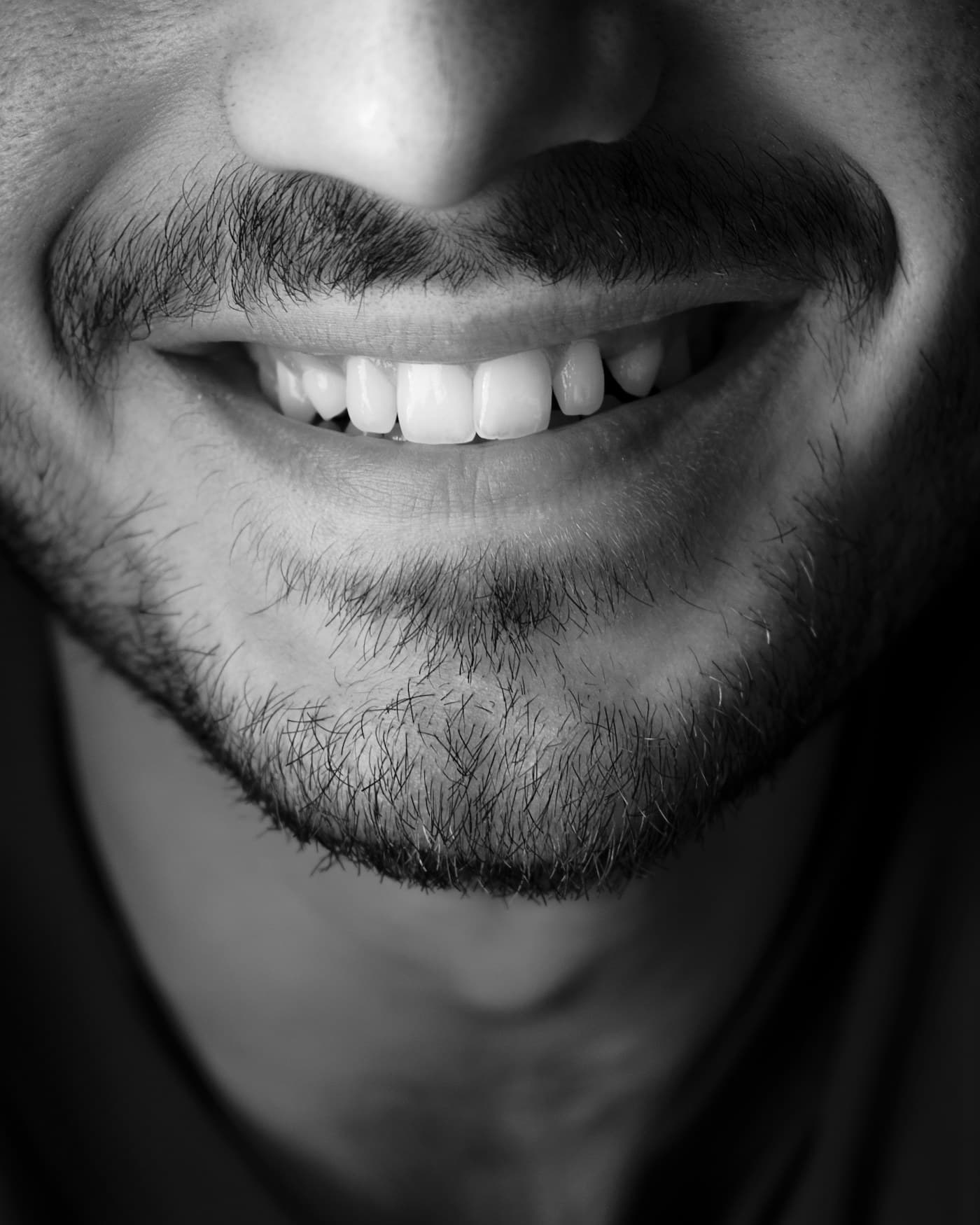 A patient photographed in monochrome, mid-smile.
